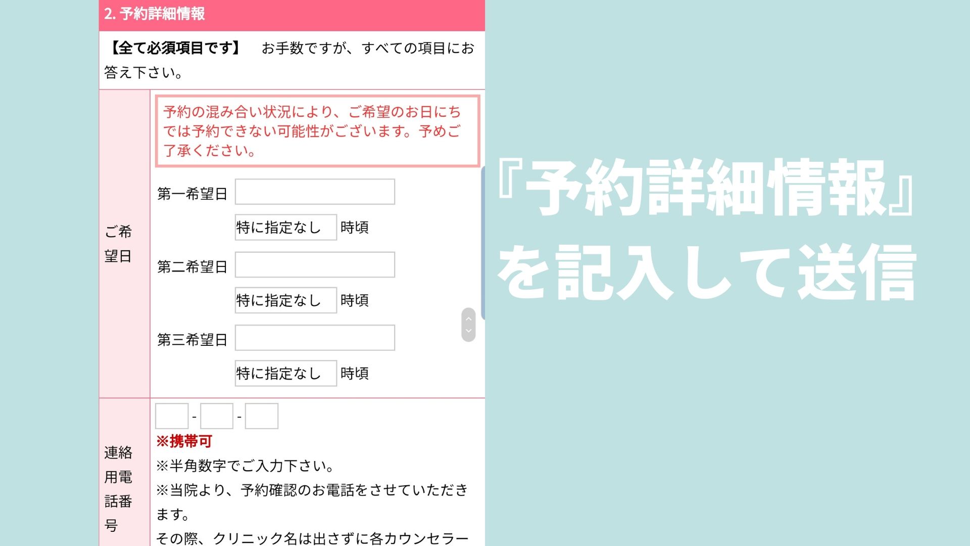 湘南美容クリニックのモニターはお得 メリットとデメリットを解説 男前クリニック 男性美容の体験情報サイト メンズ美容