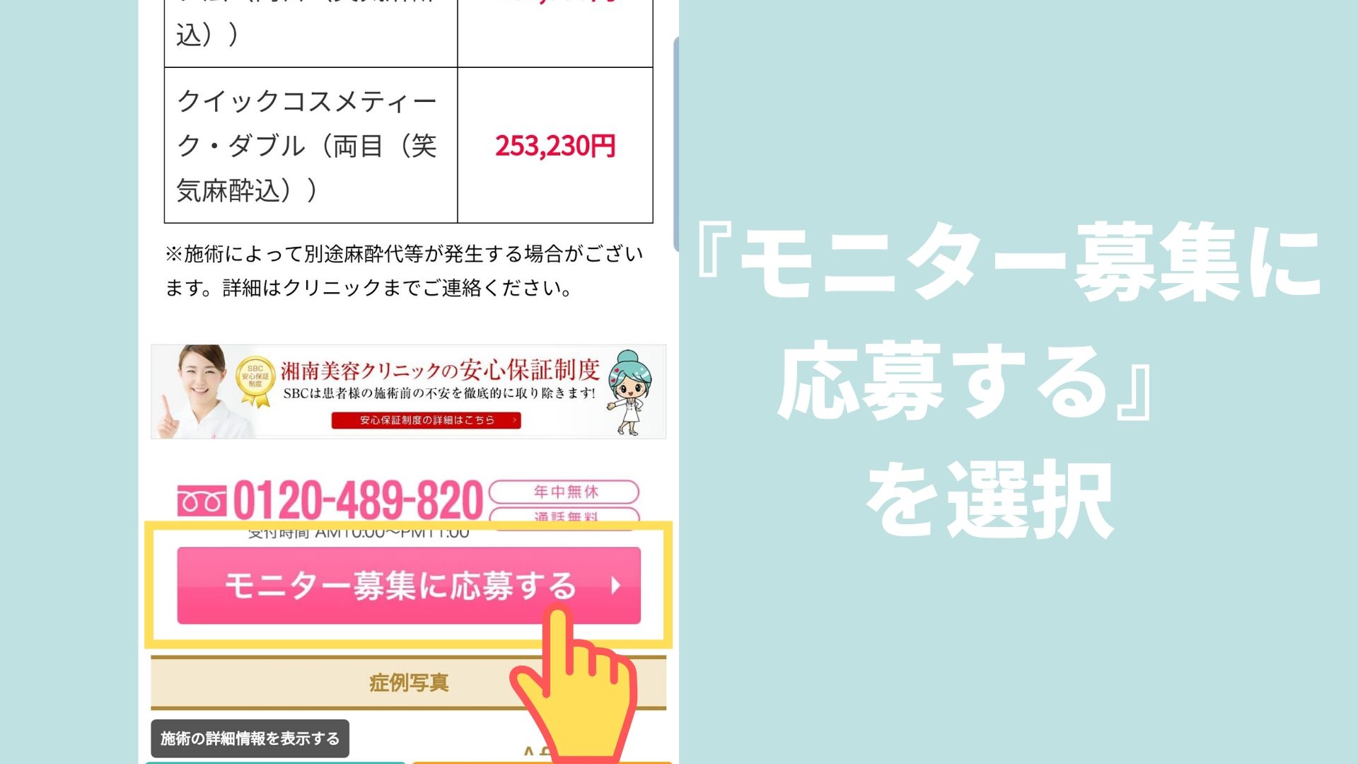 湘南美容クリニックのモニターはお得 メリットとデメリットを解説 男前クリニック 男性美容の体験情報サイト メンズ美容