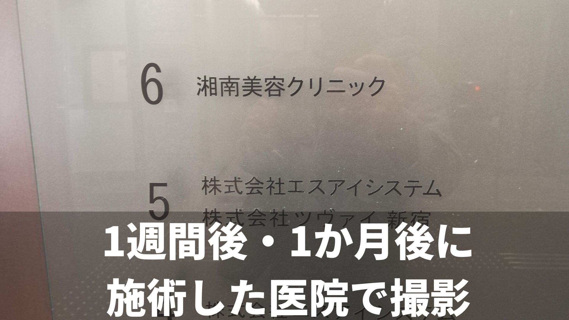 湘南美容クリニックのモニターはお得 メリットとデメリットを解説 男前クリニック 男性美容の体験情報サイト メンズ美容