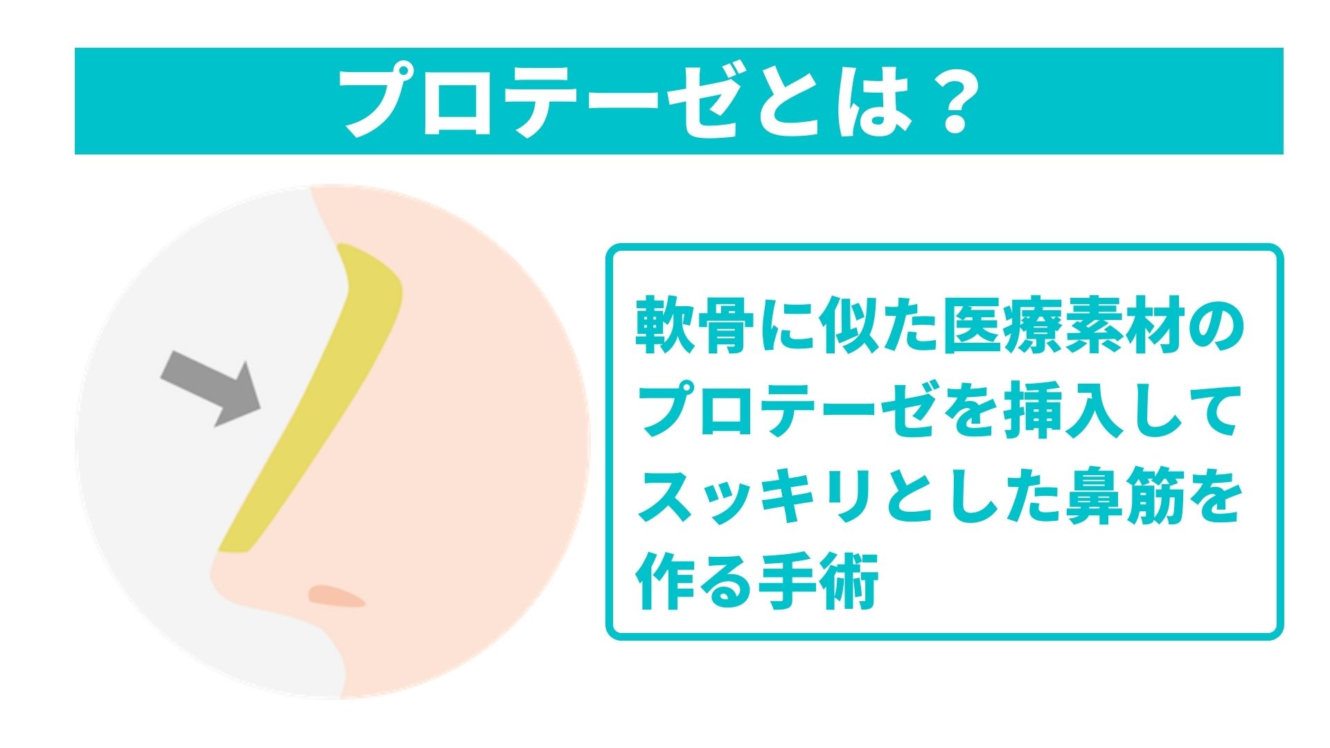 イセアクリニックプロテーゼ